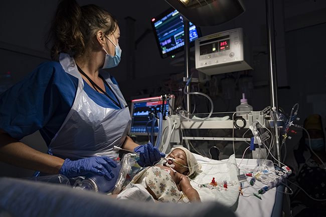 In intensive care since birth, this newborn suffers a respiratory arrest that requires the nurse to perform pulmonary ventilation using a balloon. Mayotte - 2021